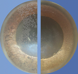 
Image au microscope : auparavant (à gauche), la chaux spongieuse pouvait se déposer. Plus tard (à droite), la chaux collée pourrait se détacher
